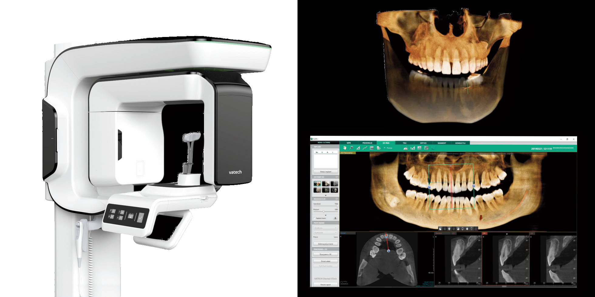 Tomografia CBCT Szczecin